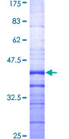 MAP2K3 / MEK3 / MKK3 Protein - 12.5% SDS-PAGE Stained with Coomassie Blue