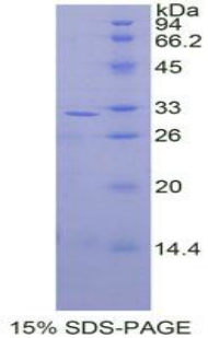 MAP2K3 / MEK3 / MKK3 Protein - Recombinant Mitogen Activated Protein Kinase Kinase 3 By SDS-PAGE