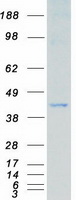 MAP2K3 / MEK3 / MKK3 Protein - Purified recombinant protein MAP2K3 was analyzed by SDS-PAGE gel and Coomassie Blue Staining