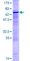 MAP2K4 / MKK4 Protein - 12.5% SDS-PAGE of human MAP2K4 stained with Coomassie Blue