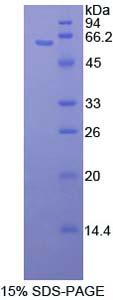 MAP2K4 / MKK4 Protein - Recombinant Mitogen Activated Protein Kinase Kinase 4 By SDS-PAGE