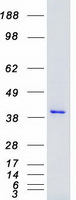 MAP2K4 / MKK4 Protein - Purified recombinant protein MAP2K4 was analyzed by SDS-PAGE gel and Coomassie Blue Staining