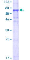 MAP2K5 / MEK5 Protein - 12.5% SDS-PAGE of human MAP2K5 stained with Coomassie Blue