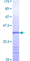 MAP2K5 / MEK5 Protein - 12.5% SDS-PAGE Stained with Coomassie Blue