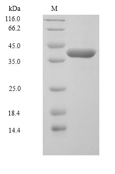 MAP2K6 / MEK6 / MKK6 Protein - (Tris-Glycine gel) Discontinuous SDS-PAGE (reduced) with 5% enrichment gel and 15% separation gel.