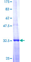 MAP2K6 / MEK6 / MKK6 Protein - 12.5% SDS-PAGE Stained with Coomassie Blue.
