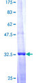 MAP2K6 / MEK6 / MKK6 Protein - 12.5% SDS-PAGE Stained with Coomassie Blue.