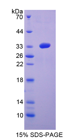 MAP2K6 / MEK6 / MKK6 Protein - Recombinant  Mitogen Activated Protein Kinase Kinase 6 By SDS-PAGE