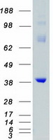 MAP2K6 / MEK6 / MKK6 Protein - Purified recombinant protein MAP2K6 was analyzed by SDS-PAGE gel and Coomassie Blue Staining