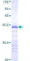 MAP3K1 / MEKK1 Protein - 12.5% SDS-PAGE Stained with Coomassie Blue.