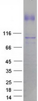 MAP3K1 / MEKK1 Protein - Purified recombinant protein MAP3K1 was analyzed by SDS-PAGE gel and Coomassie Blue Staining