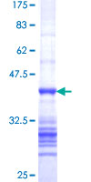 MAP3K10 / MLK2 Protein - 12.5% SDS-PAGE Stained with Coomassie Blue.