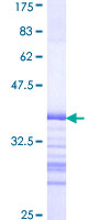 MAP3K11 / MLK3 Protein - 12.5% SDS-PAGE Stained with Coomassie Blue.