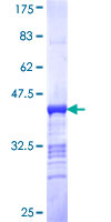 MAP3K11 / MLK3 Protein - 12.5% SDS-PAGE Stained with Coomassie Blue.