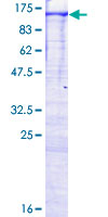 MAP3K14 Protein - 12.5% SDS-PAGE of human MAP3K14 stained with Coomassie Blue