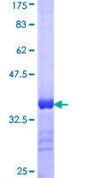 MAP3K15 / ASK3 Protein - 12.5% SDS-PAGE Stained with Coomassie Blue.
