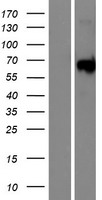 MAP3K19 / YSK4 Protein - Western validation with an anti-DDK antibody * L: Control HEK293 lysate R: Over-expression lysate