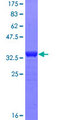 MAP3K2 / MEKK2 Protein - 12.5% SDS-PAGE Stained with Coomassie Blue.