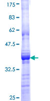 MAP3K6 / MEKK6 Protein - 12.5% SDS-PAGE Stained with Coomassie Blue.
