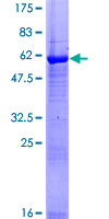 MAP3K7CL / TAK1L Protein - 12.5% SDS-PAGE of human C21orf7 stained with Coomassie Blue