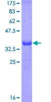MAP3K8 / TPL2 Protein - 12.5% SDS-PAGE Stained with Coomassie Blue.