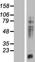 MAP4 Protein - Western validation with an anti-DDK antibody * L: Control HEK293 lysate R: Over-expression lysate