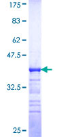 MAP4K1 / HPK1 Protein - 12.5% SDS-PAGE Stained with Coomassie Blue.