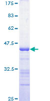 MAP4K5 Protein - 12.5% SDS-PAGE Stained with Coomassie Blue.
