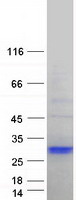 MAP6D1 Protein - Purified recombinant protein MAP6D1 was analyzed by SDS-PAGE gel and Coomassie Blue Staining