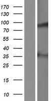 MAP9 Protein - Western validation with an anti-DDK antibody * L: Control HEK293 lysate R: Over-expression lysate