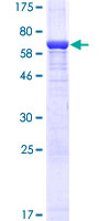 MAPK1 / ERK2 Protein - 12.5% SDS-PAGE of human MAPK1 stained with Coomassie Blue