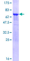 MAPK10 / JNK3 Protein - 12.5% SDS-PAGE of human MAPK10 stained with Coomassie Blue