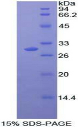 MAPK11 / SAPK2 / p38 Beta Protein - Recombinant Mitogen Activated Protein Kinase 11 By SDS-PAGE