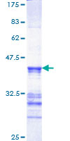 MAPK13 / p38delta Protein - 12.5% SDS-PAGE Stained with Coomassie Blue.