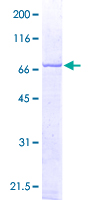 MAPK14 / p38 Protein - 12.5% SDS-PAGE of human MAPK14 stained with Coomassie Blue