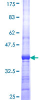 MAPK14 / p38 Protein - 12.5% SDS-PAGE Stained with Coomassie Blue.