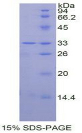 MAPK14 / p38 Protein - Recombinant Mitogen Activated Protein Kinase 14 By SDS-PAGE