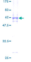 MAPK15 / ERK7 Protein - 12.5% SDS-PAGE of human MAPK15 stained with Coomassie Blue