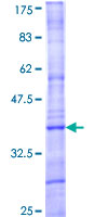 MAPK15 / ERK7 Protein - 12.5% SDS-PAGE Stained with Coomassie Blue.