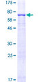MAPK3 / ERK1 Protein - 12.5% SDS-PAGE of human MAPK3 stained with Coomassie Blue