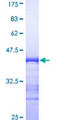 MAPK3 / ERK1 Protein - 12.5% SDS-PAGE Stained with Coomassie Blue.