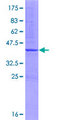 MAPK4 / ERK4 Protein - 12.5% SDS-PAGE Stained with Coomassie Blue.