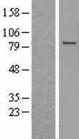 MAPK6 / ERK3 Protein - Western validation with an anti-DDK antibody * L: Control HEK293 lysate R: Over-expression lysate