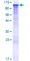 MAPK6 / ERK3 Protein - 12.5% SDS-PAGE of human MAPK6 stained with Coomassie Blue