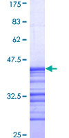 MAPK6 / ERK3 Protein - 12.5% SDS-PAGE Stained with Coomassie Blue.