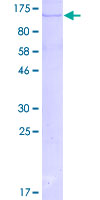 MAPK7 / ERK5 Protein - 12.5% SDS-PAGE of human MAPK7 stained with Coomassie Blue