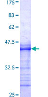 MAPK7 / ERK5 Protein - 12.5% SDS-PAGE Stained with Coomassie Blue.
