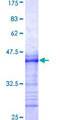 MAPK7 / ERK5 Protein - 12.5% SDS-PAGE Stained with Coomassie Blue.