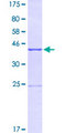 MAPK8 / JNK1 Protein - 12.5% SDS-PAGE Stained with Coomassie Blue.