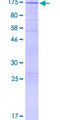 MAPK8IP2 / JIP2 Protein - 12.5% SDS-PAGE of human MAPK8IP2 stained with Coomassie Blue